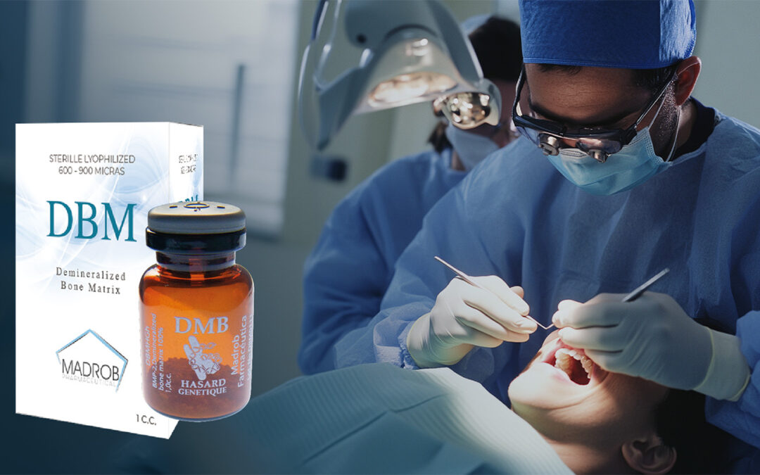 DBM Madrob: The revolutionary xenograft bone substitute for specialized surgeons and dentists.